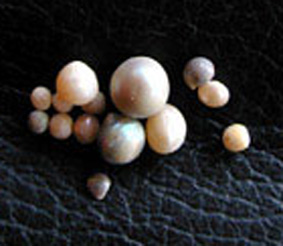 perles d'ormeau