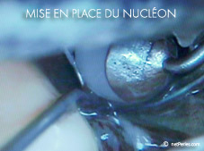 nucleon et huitre perliere